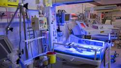 توسعه بخش NICU بیمارستان مهر ملایر، گامی بلند در ارتقای خدمات درمانی استان همدان