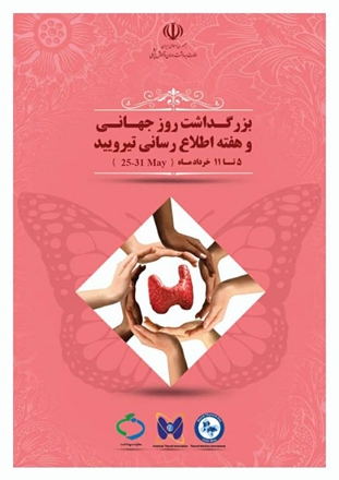 غربالگری تیروئید ۴۸۴ هزار و ۵۹۲ نوزاد در همدان