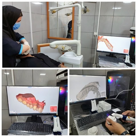 نصب اسکنر داخل‌دهانی بی‌سیم در بخش تخصصی ارتودنسی دانشکده دندانپزشکی همدان