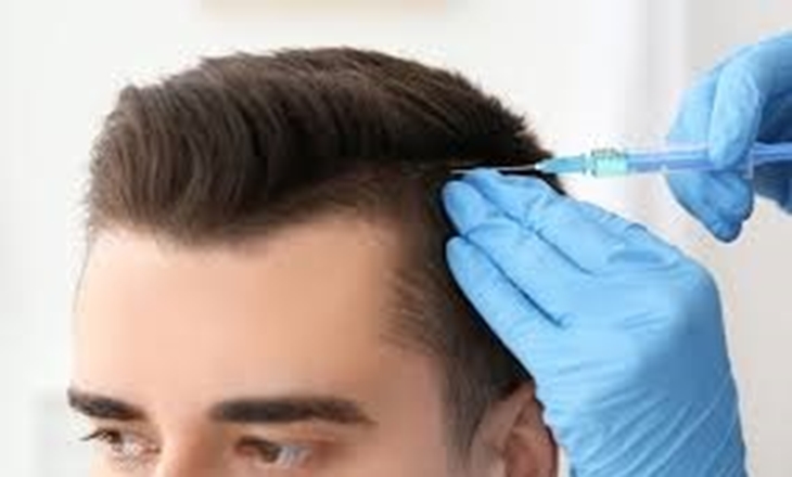  مزوتراپی راه‌حل قطعی جلوگیری از ریزش مو نیست