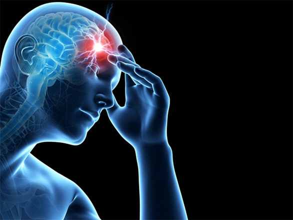 نجات در سه ساعت نخست؛ کلید بازگشت از سکته مغزی