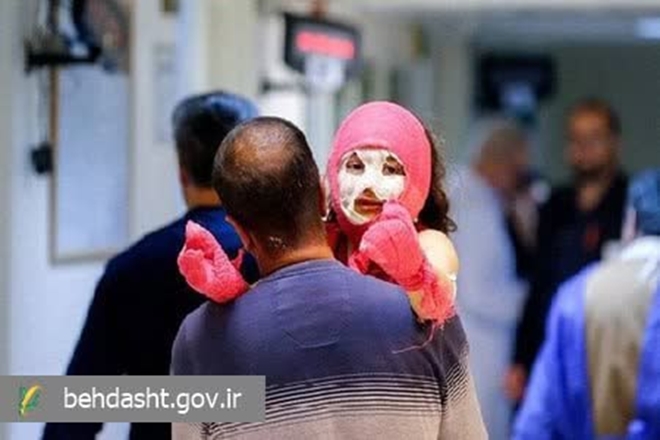 هشدار متخصص جراحی پلاستیک درباره خطرات سوختگی در ایام چهارشنبه‌سوری