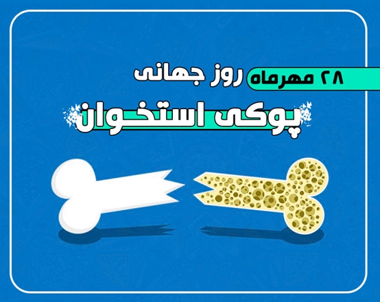 28مهرماه، روز جهانی پوکی استخوان